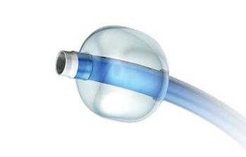 https://stryker-h.assetsadobe.com/is/image/content/dam/stryker/neurovascular/products/flowgate2-balloon-guide-catheter/images/Hero_FlowGate%202.jpg?$preset_400_235$